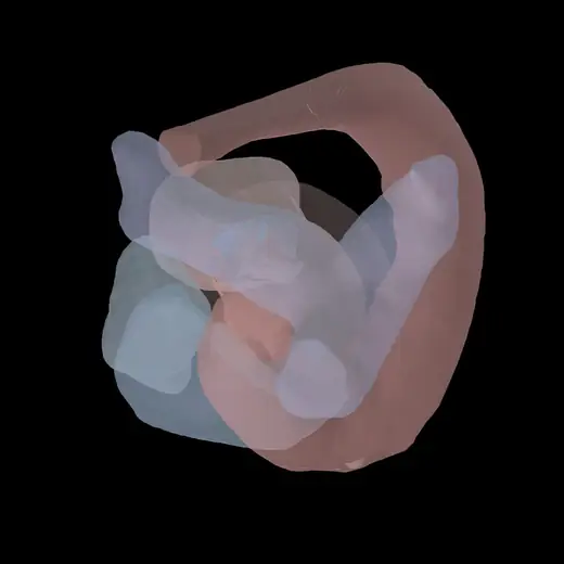 beating reconstructed heart twin
