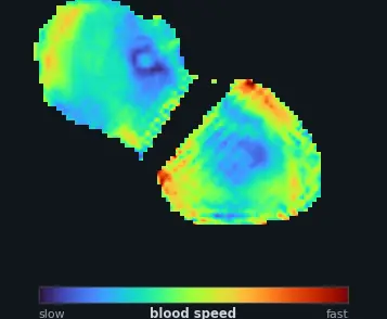 blood-speed flow field across the beat
